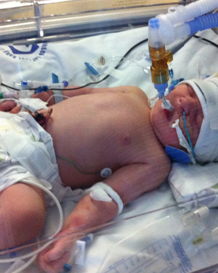 NICU Awareness Month 2019- Recognising PTSD and Trauma