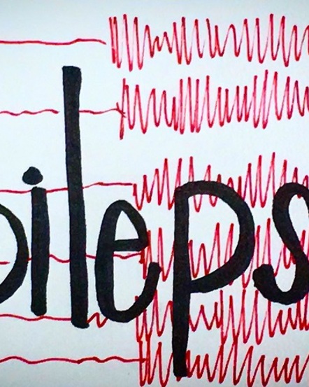 Dear Epilepsy..