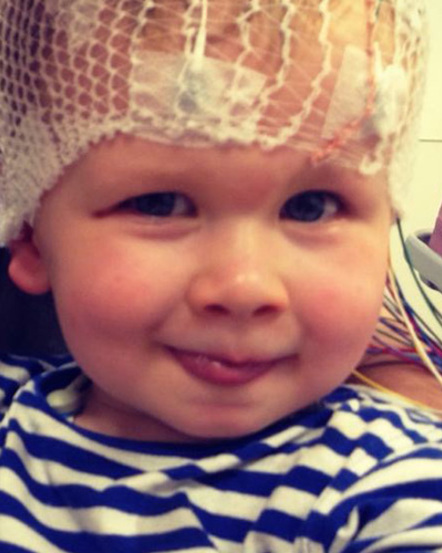 What Is It Like to Parent a Child With Epilepsy?