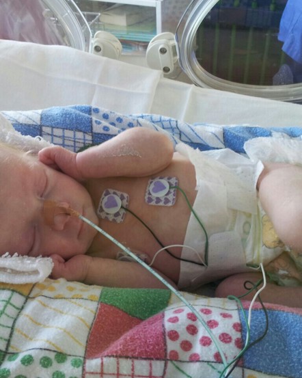 Prematurity - Our Story