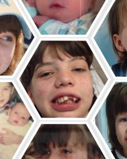 Epilepsy: The Jigsaw Destroyer
