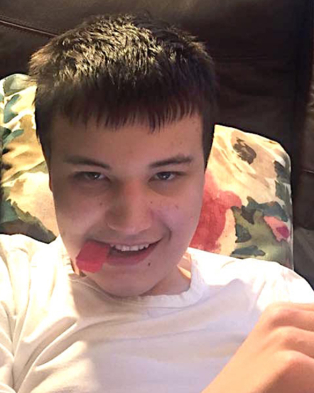 Autism, Epilepsy and the one-in-three Chance of Both