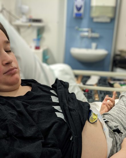 The Monster We Live With (Epilepsy)