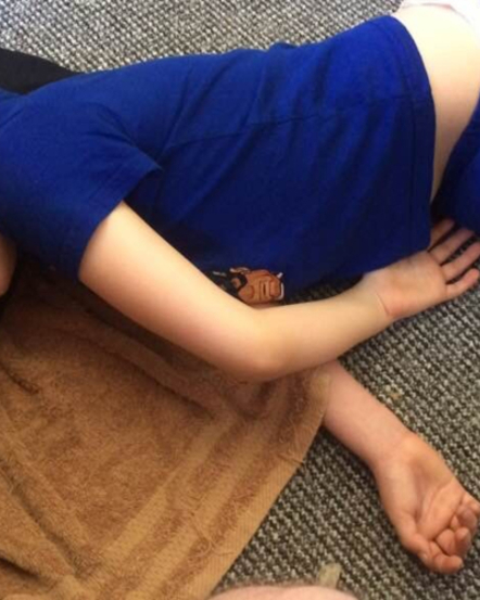 Podcast: What a Four-Minute Seizure is Like