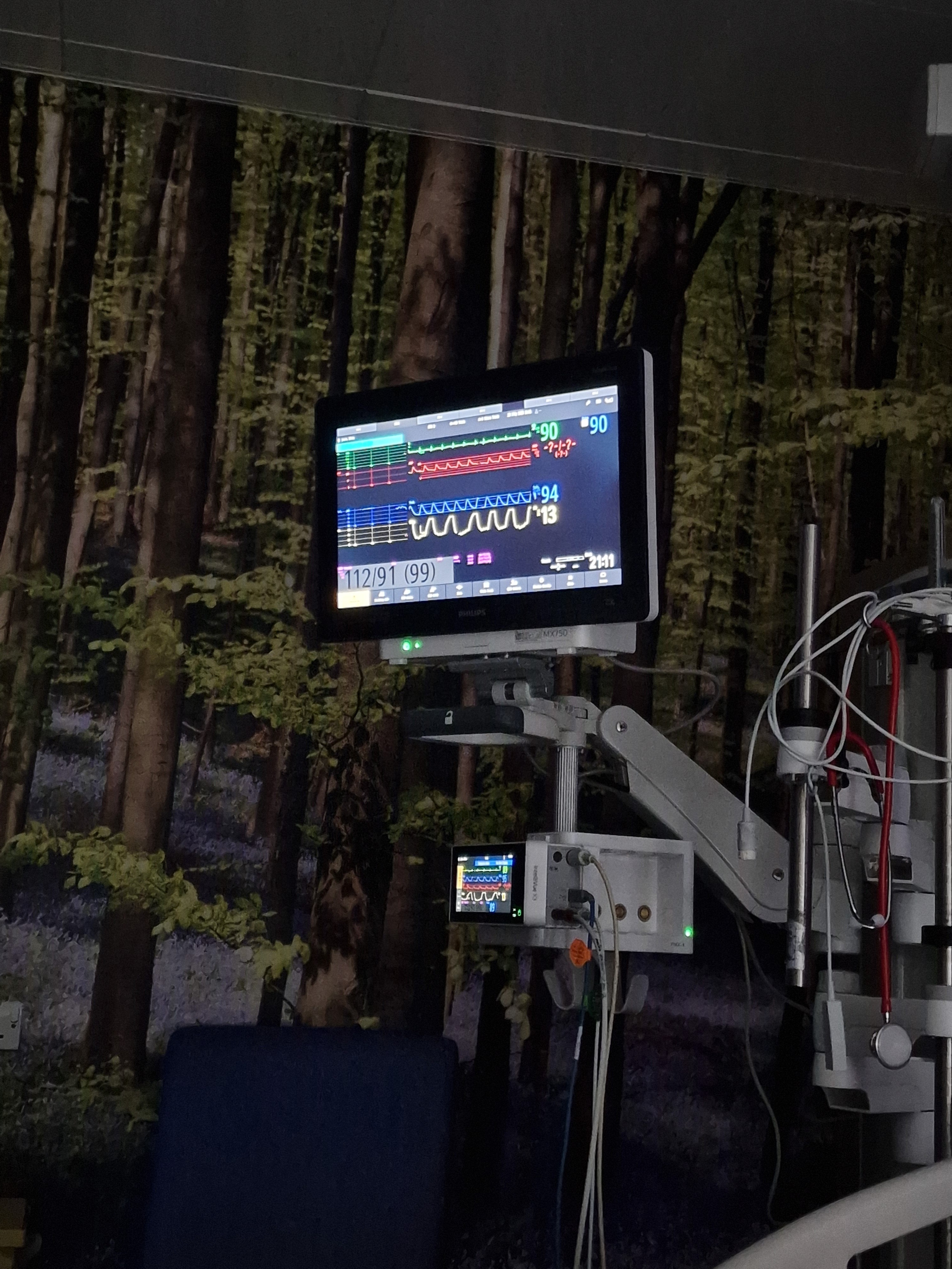 A patient monitoring screen at a hospital