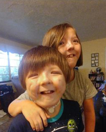 Cleft and Craniofacial Awareness: Celebrating our differences